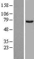 PRMT5 Human Over-expression Lysates NM_006109