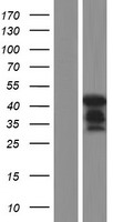 KPC2 (UBAC1) Human Over-expression Lysates NM_016172