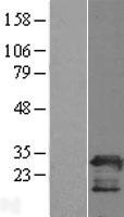 PGRMC2 Human Over-expression Lysates NM_006320