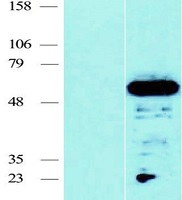 CFDP1 Human Over-expression Lysates NM_006324
