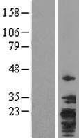 TMEM147 Human Over-expression Lysates NM_032635