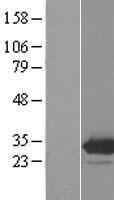 EMG1 Human Over-expression Lysates NM_006331