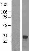 IFI30 Human Over-expression Lysates NM_006332