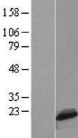 C1D Human Over-expression Lysates NM_006333