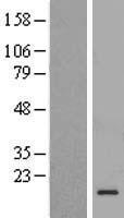 C1D Human Over-expression Lysates NM_173177