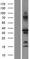 Cyclophilin E (PPIE) Human Over-expression Lysates NM_001195007