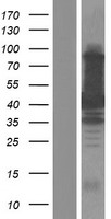 TAB1 Human Over-expression Lysates NM_153497