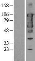TACC3 Human Over-expression Lysates NM_006342