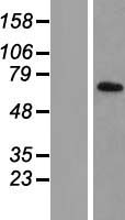 TIMM44 Human Over-expression Lysates NM_006351