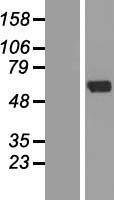 ZNF238 (ZBTB18) Human Over-expression Lysates NM_205768