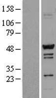 TADA3L (TADA3) Human Over-expression Lysates NM_006354
