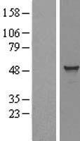 TADA3L (TADA3) Human Over-expression Lysates NM_133480