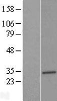 SLC25A17 Human Over-expression Lysates NM_006358