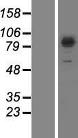 SEC23B Human Over-expression Lysates NM_006363