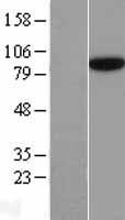 SEC23B Human Over-expression Lysates NM_032985