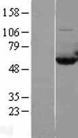 CAP1 Human Over-expression Lysates NM_006367