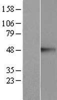 CREB3 Human Over-expression Lysates NM_006368