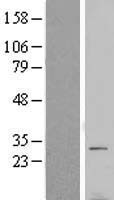 VTI1B Human Over-expression Lysates NM_006370
