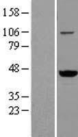 ls010493 vat1 human over expression lysates nm 006373 wb testing 1