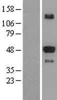STK25 Human Over-expression Lysates NM_006374