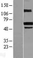 PRMT4 (CARM1) Human Over-expression Lysates NM_199141