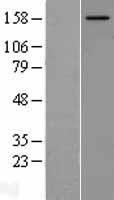 NCOA2 Human Over-expression Lysates NM_006540