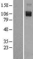 Semaphorin 4D (SEMA4D) Human Over-expression Lysates NM_006378