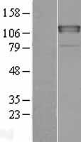 CHERP Human Over-expression Lysates NM_006387