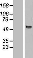 KAT5 Human Over-expression Lysates NM_182709