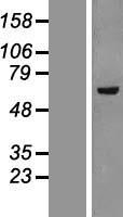 KAT5 Human Over-expression Lysates NM_182710