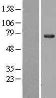 NOL5A (NOP56) Human Over-expression Lysates NM_006392