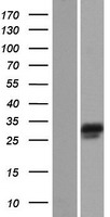 Nebulette (NEBL) Human Over-expression Lysates NM_213569