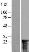 ZNRD2 Human Over-expression Lysates NM_006396