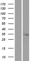 Ribonuclease H2