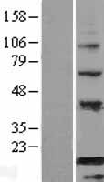BATF Human Over-expression Lysates NM_006399