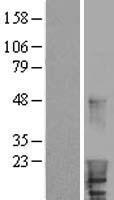 HBXIP (LAMTOR5) Human Over-expression Lysates NM_006402