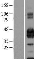 PROCR Human Over-expression Lysates NM_006404