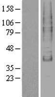 TM9SF1 Human Over-expression Lysates NM_006405
