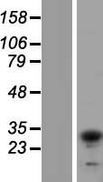 TIP30 (HTATIP2) Human Over-expression Lysates NM_001098521