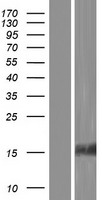 TIP30 (HTATIP2) Human Over-expression Lysates NM_001098523