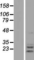ls010555 agpat2 human over expression lysates nm 001012727 wb testing 2