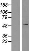 SPTLC1 Human Over-expression Lysates NM_006415
