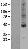 ls010559 slc35a1 human over expression lysates nm 006416 wb testing 1