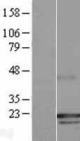 ls010567 pra1 rabac1 human over expression lysates nm 006423 wb testing 1