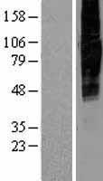 ls010568 slc34a2 human over expression lysates nm 006424 wb testing 1