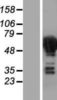 CRMP3 (DPYSL4) Human Over-expression Lysates NM_006426