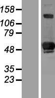 ls010572 siva siva1 human over expression lysates nm 006427 wb testing 1