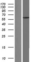 TCP1 eta (CCT7) Human Over-expression Lysates NM_006429