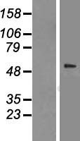 TCP1 beta (CCT2) Human Over-expression Lysates NM_006431