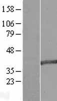 ls010586 mab21l2 human over expression lysates nm 006439 wb testing 1
